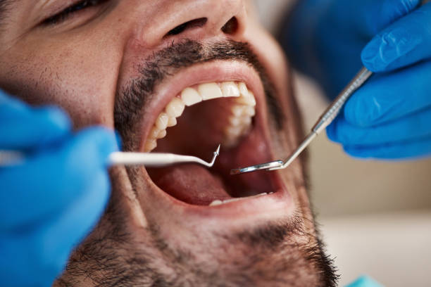 Best Emergency Root Canal Treatment in Holt, MI