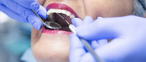 Best Emergency Wisdom Teeth Removal in Holt, MI